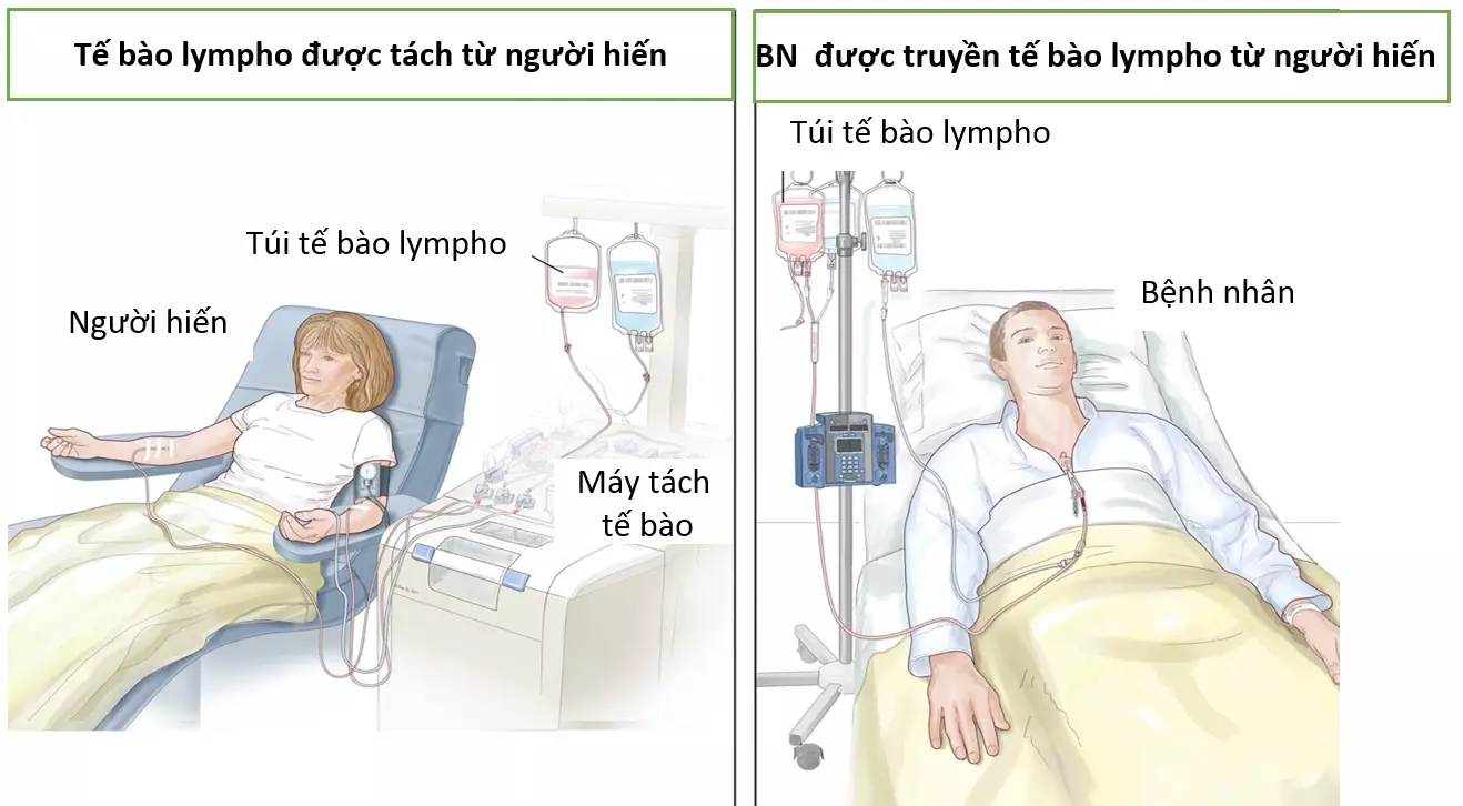 truyền tế bào lympho từ người hiến