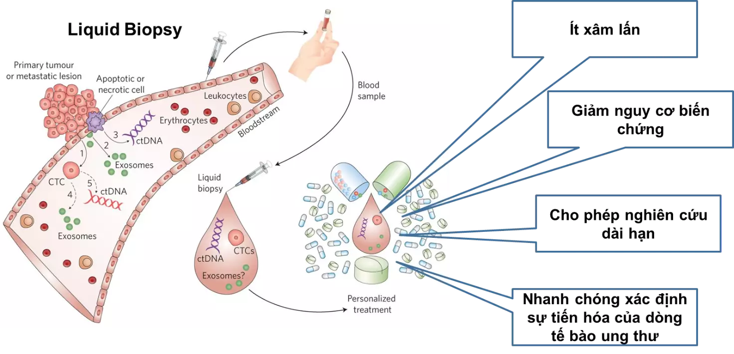 xét nghiệm chẩn đoán bằng sinh thiết lỏng và giải trình tự gen thế hệ mới