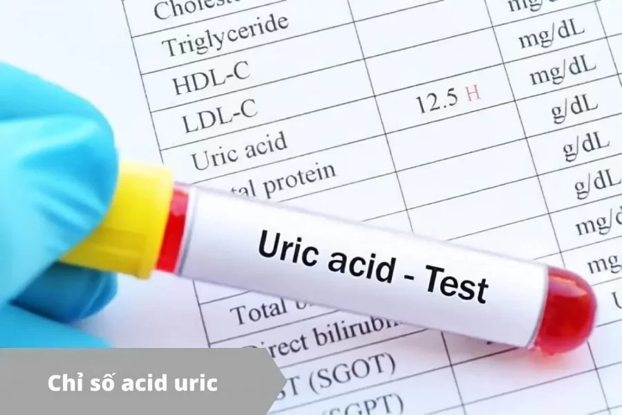 chỉ số acid uric là gì