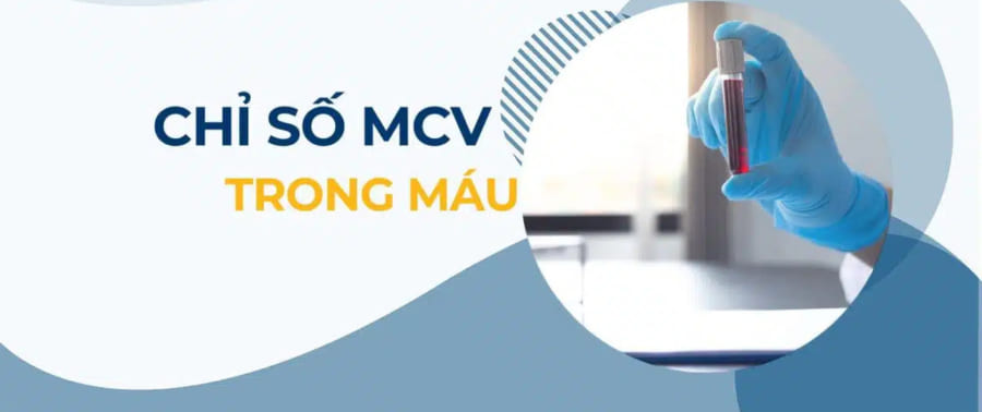 chỉ số mcv