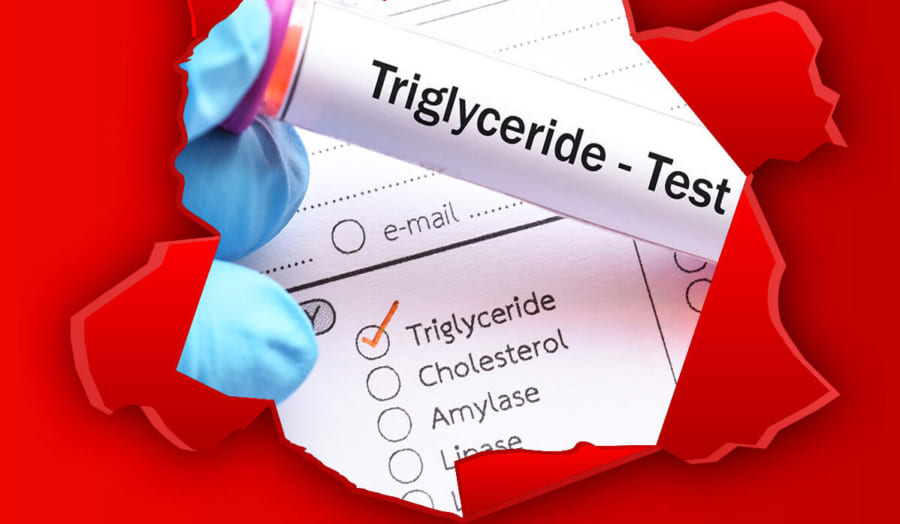 chỉ số triglyceride