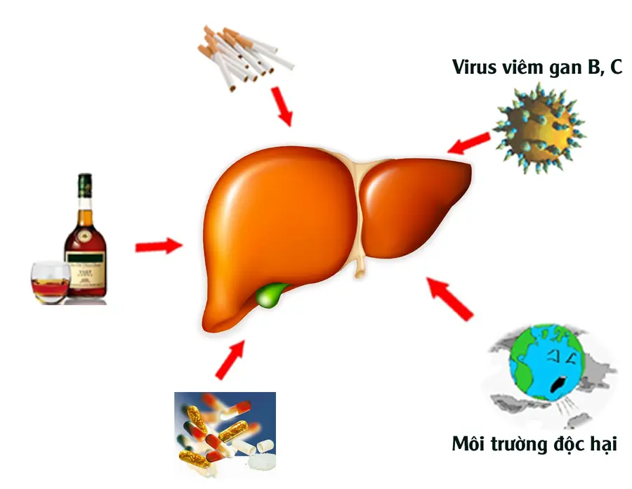 nguyên nhân khiến chỉ số ggt tăng