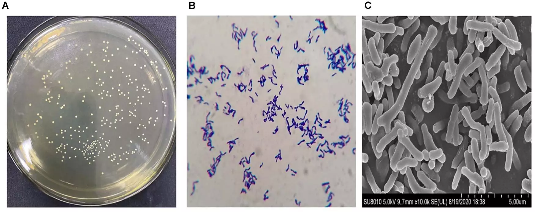 hình ảnh bifidobacterium longum