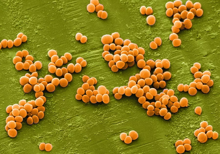 staphylococcus aureus