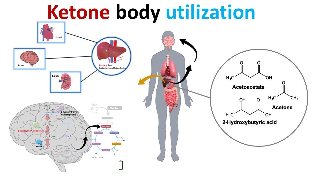 tác hại với cơ thể khi nồng độ ketone cao