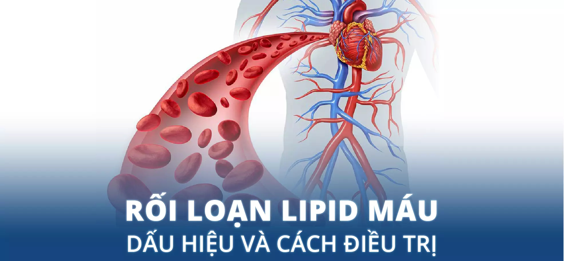 rối loạn lipid máu là gì