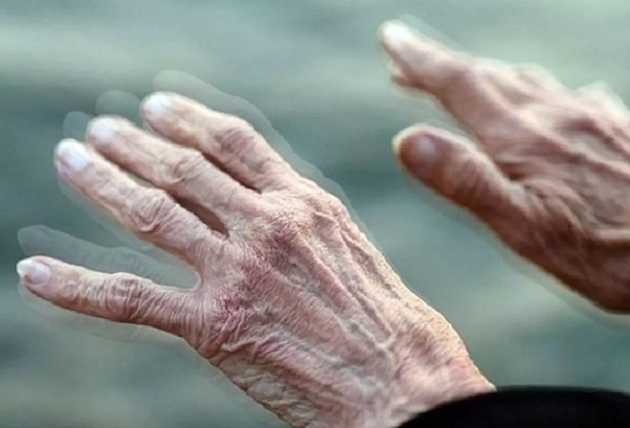 bệnh parkinson ở người cao tuổi