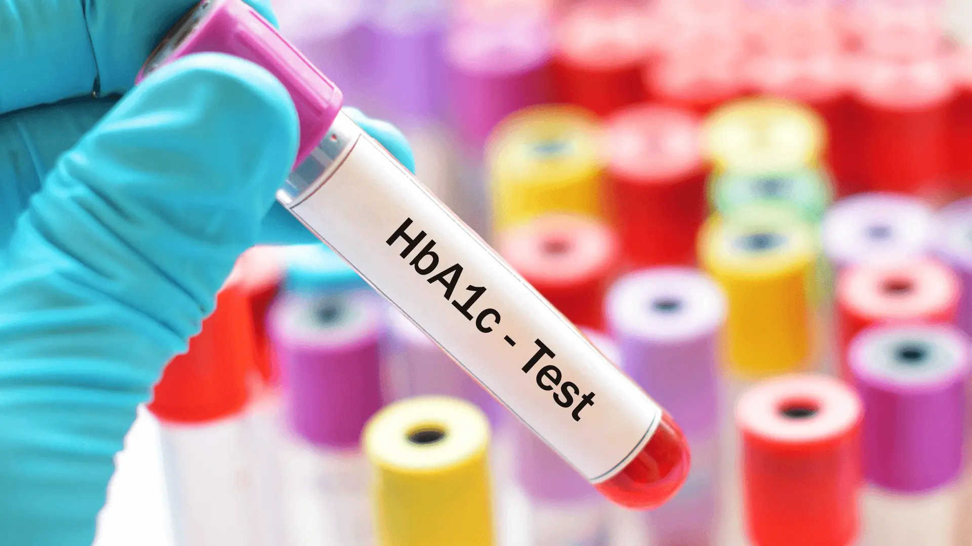 hba1c là gì