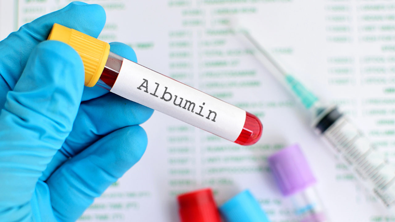 xét nghiệm định lượng albumin