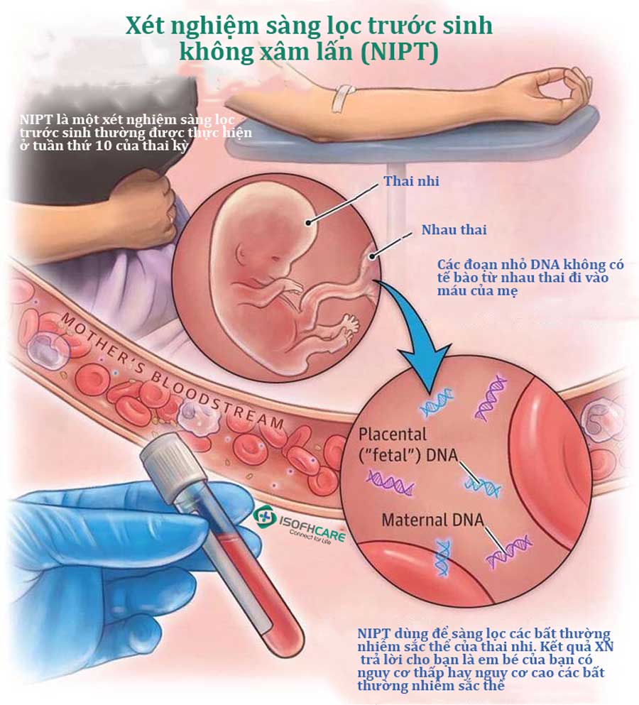 xét nghiệm sàng lọc nipt